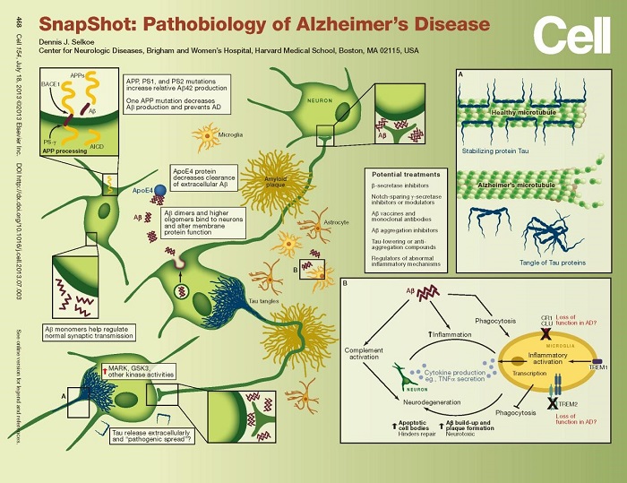 Alzheimer-disease.jpg